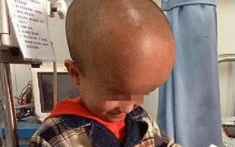 找人代生宝宝头大是什么原因